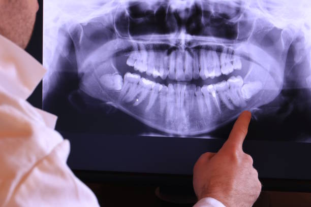 Best Cosmetic Emergency Dentistry in Porcupine, SD